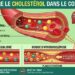 Cholestérol et stress